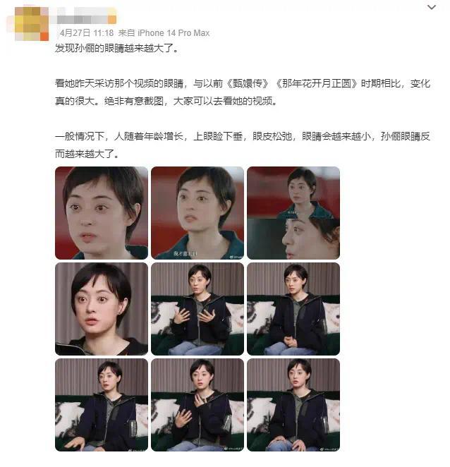 孙俪否认自己眼睛大是得了甲亢：是从小就大的